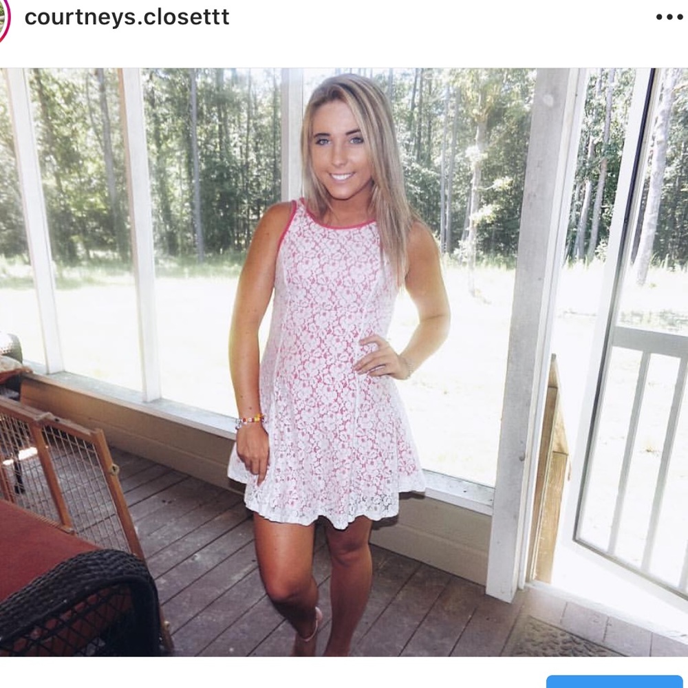 lace dress